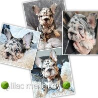 French Bulldog - Both